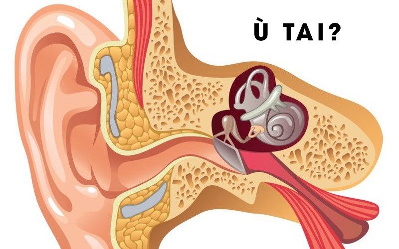 Tại sao đi thang máy bị ù tai